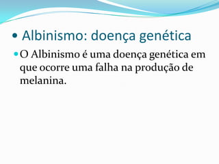 • Albinismo: doença genéticaO Albinismo é uma doença genética em que ocorre uma falha na produção de melanina.