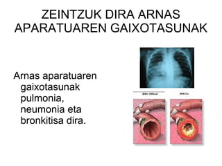 ZEINTZUK DIRA ARNAS APARATUAREN GAIXOTASUNAK Arnas aparatuaren gaixotasunak pulmonia, neumonia eta bronkitisa dira.  