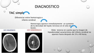DIAGNOSTICO
Diferenciar entre hemorragia e
infarto cerebral
Hemorragia aparece inmediatamente un aumento
de la densidad del tejido nervioso en el sitio de la
lesión.
Debe tenerse en cuenta que la imagen de
hipodensidad característica del infarto cerebral no
aparece hasta después de 24 a 48 horas.
TAC simple
 