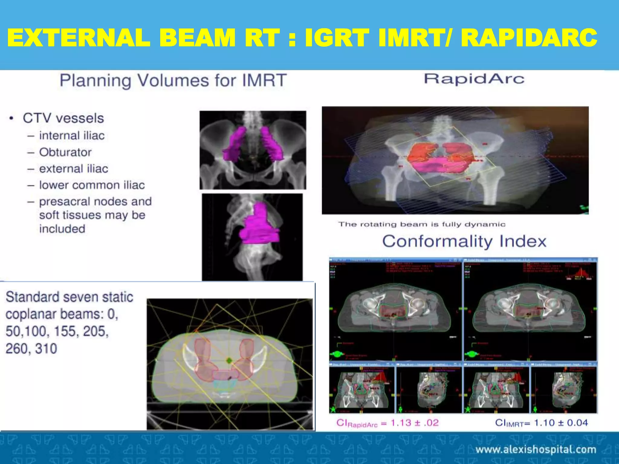 Ingal Rbt Brachytherapy IGABT | PPTX