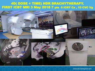 4D( DOSE + TIME) HDR BRACHYTHERAPY.
FIRST ICBT MRI 3 May 2018 7 pts 6 ICRT Cx , 10 CVC Vg
 