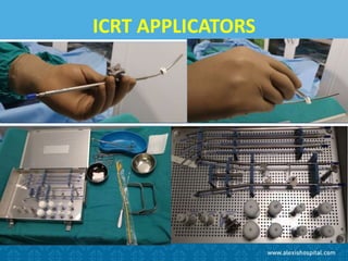 ICRT APPLICATORS
 