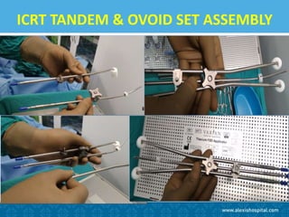 ICRT TANDEM & OVOID SET ASSEMBLY
 