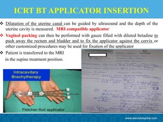 ICRT BT APPLICATOR INSERTION
 Dilatation of the uterine canal can be guided by ultrasound and the depth of the
uterine cavity is measured. MRI compatible applicator
 Vaginal packing can then be performed with gauze filled with diluted betadine to
push away the rectum and bladder and to fix the applicator against the cervix or
other customized procedures may be used for fixation of the applicator
 Patient is transferred to the MRI
in the supine treatment position.
 