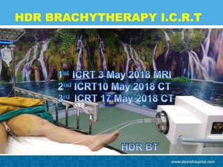 HDR BRACHYTHERAPY I.C.R.T
 
