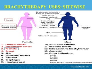 BRACHYTHERAPY USES: SITEWISE
 