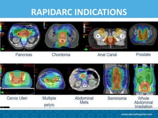 Cd R Radiotherapy Advanced Radiotherapy in Cancer Care in Central India- ALEXIS NAGPUR ...