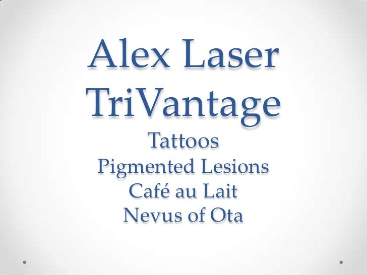 alex trivantage laser tattoo brown spots orange county ca alex trivantage laser tattoo brown spots orange county ca
