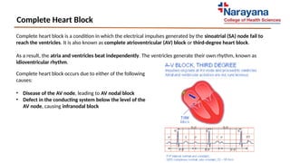 Heart Block ppt made by 1sy year NH student | PPTX