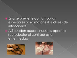  Esta se previene con ampollas
  especiales para matar estas clases de
  infecciones
 Así pueden quedar nuestros aparato
  reproductor al contraer esta
  enfermedad
 
