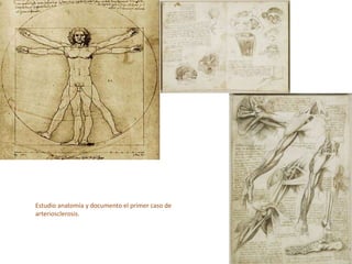 Estudio anatomía y documento el primer caso de
arteriosclerosis.
 
