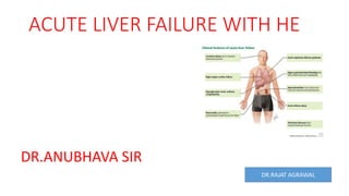 ACUTE LIVER FAILURE WITH HE
DR.ANUBHAVA SIR
DR.RAJAT AGRAWAL
 