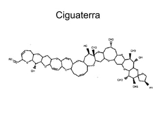 Ciguaterra
 