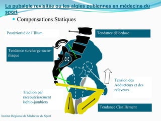 La pubalgie revisitée ou les algies pubiennes en médecine du
sport
Institut Régional de Médecine du Sport
Compensations Statiques
Postériorité de l’Ilium
Traction par
raccourcissement
ischio-jambiers
Tension des
Adducteurs et des
releveurs
Tendance Cisaillement
Tendance surcharge sacro-
iliaque
Tendance délordose
 