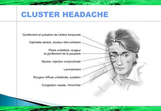 Gonflement et pulsation de l’artère temporale Céphalée sévère, douleur rétro-orbitaire Ptosis unilatéral, rougeur et gonflement de la paupière Myosis, injection conjonctivale Larmoiement Rougeur diffuse unilatérale, sudation Congestion nasale, rhinorrhée CLUSTER HEADACHE 