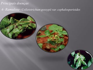 Principais doenças
4- Ramulose- Colletotrichum gossypii var. cephalosporioides
 
