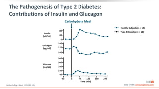 120
60
0
100
120
140
140
80
360
300
240
The Pathogenesis of Type 2 Diabetes:
Contributions of Insulin and Glucagon
Müller. N Engl J Med. 1970;283:109. Slide credit: clinicaloptions.com
Carbohydrate Meal
-60 120 180 240
Time (min)
Insulin
(µU/mL)
Glucagon
(pg/mL)
Glucose
(mg/dL)
Healthy Subjects (n = 14)
60
0
Type 2 Diabetes (n = 12)
 