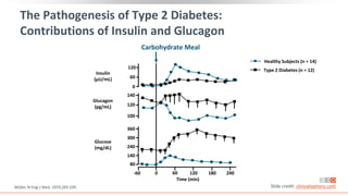 120
60
0
100
120
140
140
80
360
300
240
The Pathogenesis of Type 2 Diabetes:
Contributions of Insulin and Glucagon
Müller. N Engl J Med. 1970;283:109. Slide credit: clinicaloptions.com
Carbohydrate Meal
-60 120 180 240
Time (min)
Insulin
(µU/mL)
Glucagon
(pg/mL)
Glucose
(mg/dL)
Healthy Subjects (n = 14)
Type 2 Diabetes (n = 12)
60
0
 