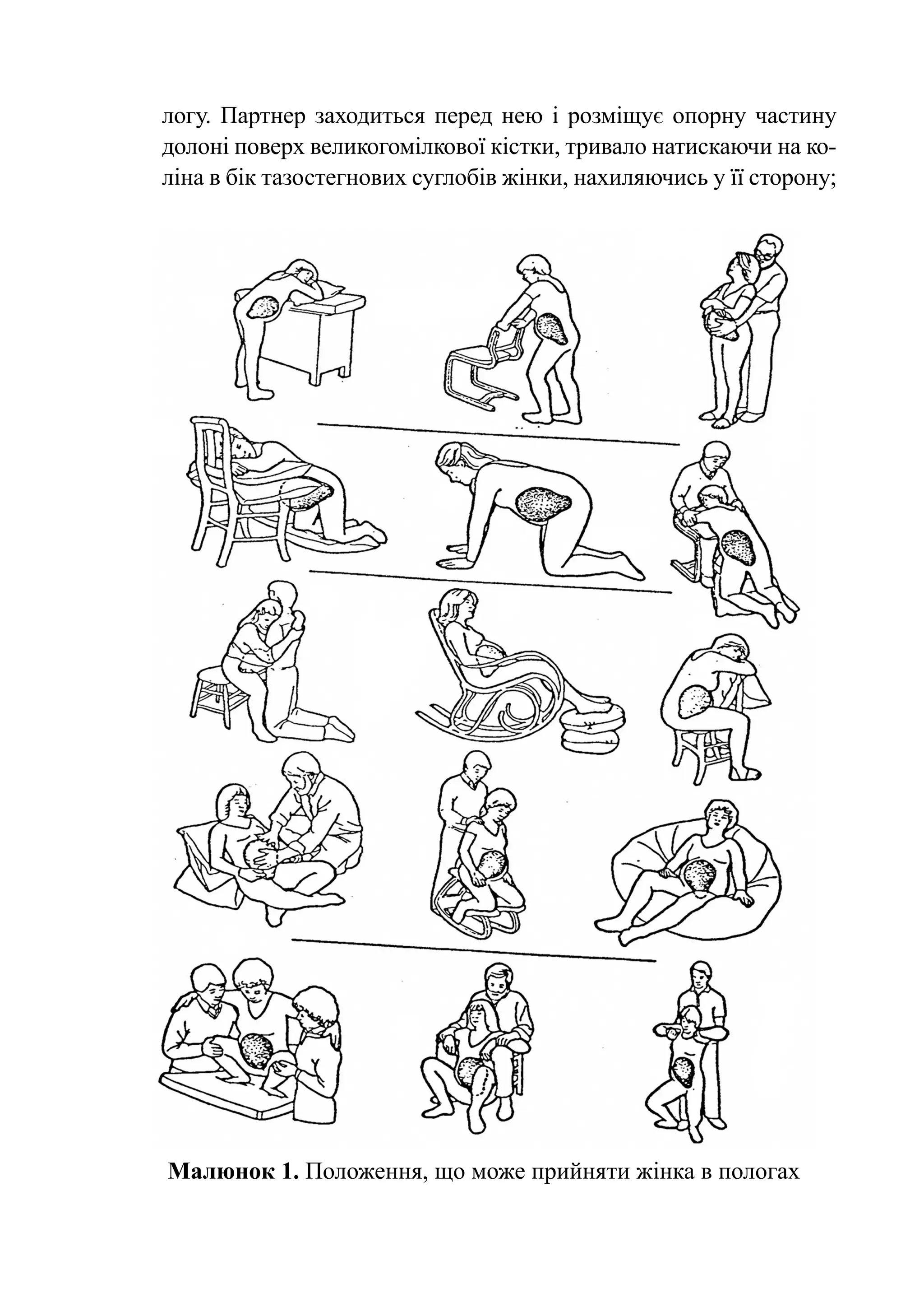 логу. Партнер заходиться перед нею і розміщує опорну частину
долоні поверх великогомілкової кістки, тривало натискаючи на ко-
ліна в бік тазостегнових суглобів жінки, нахиляючись у її сторону;




Малюнок 1. Положення, що може прийняти жінка в пологах
 