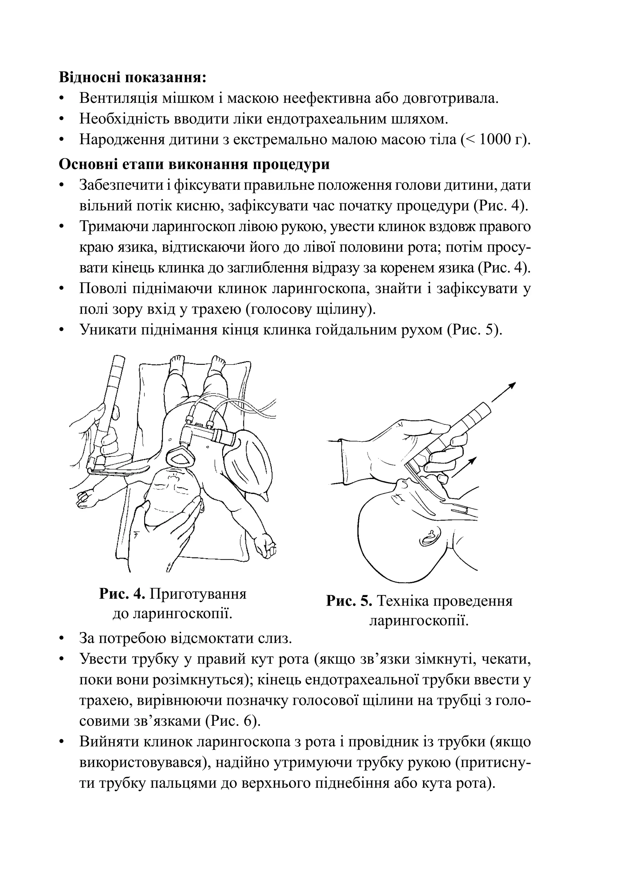 Відносні показання:
•	 Вентиляція мішком і маскою неефективна або довготривала.
•	 Необхідність вводити ліки ендотрахеальним шляхом.
•	 Народження дитини з екстремально малою масою тіла (< 1000 г).
Основні етапи виконання процедури
•	 Забезпечити і фіксувати правильне положення голови дитини, дати
   вільний потік кисню, зафіксувати час початку процедури (Рис. 4).
•	Тримаючи ларингоскоп лівою рукою, увести клинок вздовж правого
   краю язика, відтискаючи його до лівої половини рота; потім просу-
   вати кінець клинка до заглиблення відразу за коренем язика (Рис. 4).
•	 Поволі піднімаючи клинок ларингоскопа, знайти і зафіксувати у
   полі зору вхід у трахею (голосову щілину).
•	 Уникати піднімання кінця клинка гойдальним рухом (Рис. 5).




      Рис. 4. Приготування              Рис. 5. Техніка проведення
       до ларингоскопії.                      ларингоскопії.
•	 За потребою відсмоктати слиз.
•	 Увести трубку у правий кут рота (якщо зв’язки зімкнуті, чекати,
   поки вони розімкнуться); кінець ендотрахеальної трубки ввести у
   трахею, вирівнюючи позначку голосової щілини на трубці з голо-
   совими зв’язками (Рис. 6).
•	 Вийняти клинок ларингоскопа з рота і провідник із трубки (якщо
   використовувався), надійно утримуючи трубку рукою (притисну-
   ти трубку пальцями до верхнього піднебіння або кута рота).
 