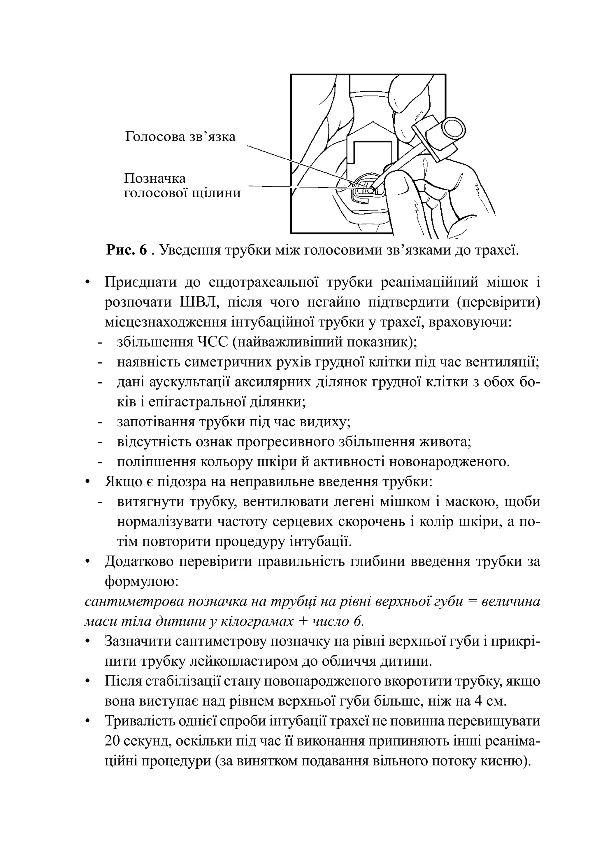 Голосова зв’язка

     Позначка
     голосової щілини


   Рис. 6 . Уведення трубки між голосовими зв’язками до трахеї.

•	 Приєднати до ендотрахеальної трубки реанімаційний мішок і
    розпочати ШВЛ, після чого негайно підтвердити (перевірити)
    місцезнаходження інтубаційної трубки у трахеї, враховуючи:
  -	 збільшення ЧСС (найважливіший показник);
  -	 наявність симетричних рухів грудної клітки під час вентиляції;
  -	 дані аускультації аксилярних ділянок грудної клітки з обох бо-
      ків і епігастральної ділянки;
  -	 запотівання трубки під час видиху;
  -	 відсутність ознак прогресивного збільшення живота;
  -	 поліпшення кольору шкіри й активності новонародженого.
•	 Якщо є підозра на неправильне введення трубки:
  -	 витягнути трубку, вентилювати легені мішком і маскою, щоби
      нормалізувати частоту серцевих скорочень і колір шкіри, а по-
      тім повторити процедуру інтубації.
•	 Додатково перевірити правильність глибини введення трубки за
    формулою:
сантиметрова позначка на трубці на рівні верхньої губи = величина
маси тіла дитини у кілограмах + число 6.
•	 Зазначити сантиметрову позначку на рівні верхньої губи і прикрі-
    пити трубку лейкопластиром до обличчя дитини.
•	 Після стабілізації стану новонародженого вкоротити трубку, якщо
    вона виступає над рівнем верхньої губи більше, ніж на 4 см.
•	Тривалість однієї спроби інтубації трахеї не повинна перевищувати
    20 секунд, оскільки під час її виконання припиняють інші реаніма-
    ційні процедури (за винятком подавання вільного потоку кисню).
 