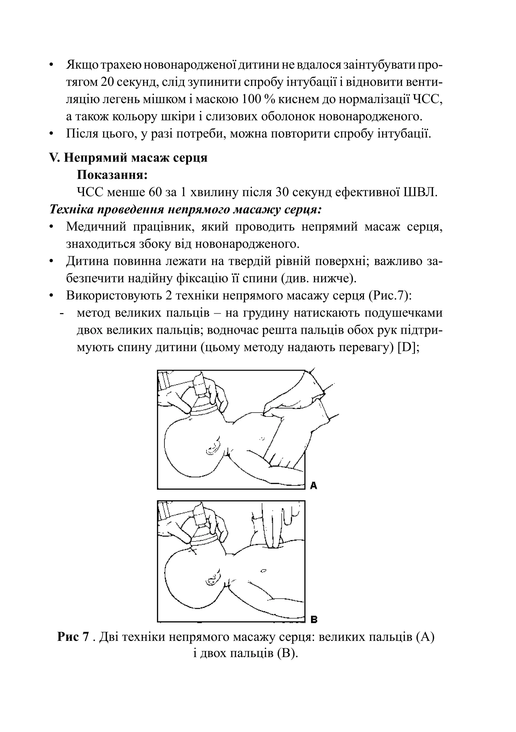 •	 Якщо трахею новонародженої дитини не вдалося заінтубувати про-
   тягом 20 секунд, слід зупинити спробу інтубації і відновити венти-
   ляцію легень мішком і маскою 100 % киснем до нормалізації ЧСС,
   а також кольору шкіри і слизових оболонок новонародженого.
•	 Після цього, у разі потреби, можна повторити спробу інтубації.
V. Непрямий масаж серця
      Показання:
      ЧСС менше 60 за 1 хвилину після 30 секунд ефективної ШВЛ.
Техніка проведення непрямого масажу серця:
•	 Медичний працівник, який проводить непрямий масаж серця,
    знаходиться збоку від новонародженого.
•	 Дитина повинна лежати на твердій рівній поверхні; важливо за-
    безпечити надійну фіксацію її спини (див. нижче).
•	 Використовують 2 техніки непрямого масажу серця (Рис.7):
  -	 метод великих пальців – на грудину натискають подушечками
      двох великих пальців; водночас решта пальців обох рук підтри-
      мують спину дитини (цьому методу надають перевагу) [D];




 Рис 7 . Дві техніки непрямого масажу серця: великих пальців (А)
                         і двох пальців (В).
 