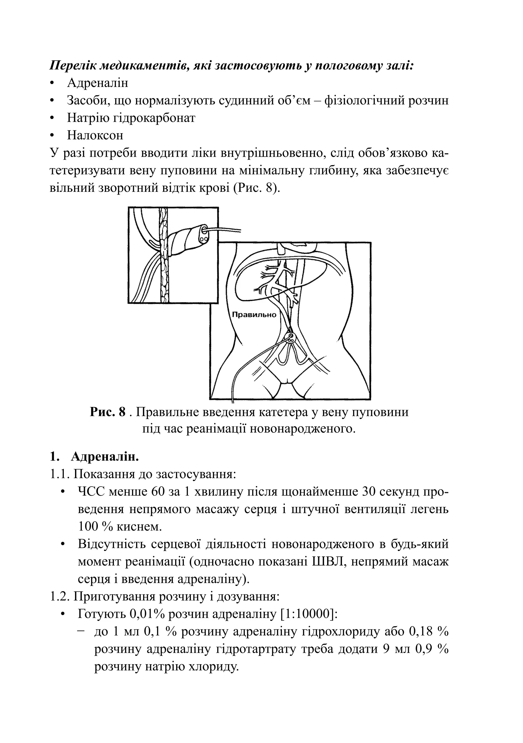Перелік медикаментів, які застосовують у пологовому залі:
•	 Адреналін
•	 Засоби, що нормалізують судинний об’єм – фізіологічний розчин
•	 Натрію гідрокарбонат
•	 Налоксон
У разі потреби вводити ліки внутрішньовенно, слід обов’язково ка-
тетеризувати вену пуповини на мінімальну глибину, яка забезпечує
вільний зворотний відтік крові (Рис. 8).




      Рис. 8 . Правильне введення катетера у вену пуповини
                під час реанімації новонародженого.

1.	 Адреналін.
1.1. Показання до застосування:
  •	 ЧСС менше 60 за 1 хвилину після щонайменше 30 секунд про-
     ведення непрямого масажу серця і штучної вентиляції легень
     100 % киснем.
  •	 Відсутність серцевої діяльності новонародженого в будь-який
     момент реанімації (одночасно показані ШВЛ, непрямий масаж
     серця і введення адреналіну).
1.2. Приготування розчину і дозування:
  •	 Готують 0,01% розчин адреналіну [1:10000]:
     −	 до 1 мл 0,1 % розчину адреналіну гідрохлориду або 0,18 %
        розчину адреналіну гідротартрату треба додати 9  мл 0,9  %
        розчину натрію хлориду.
 