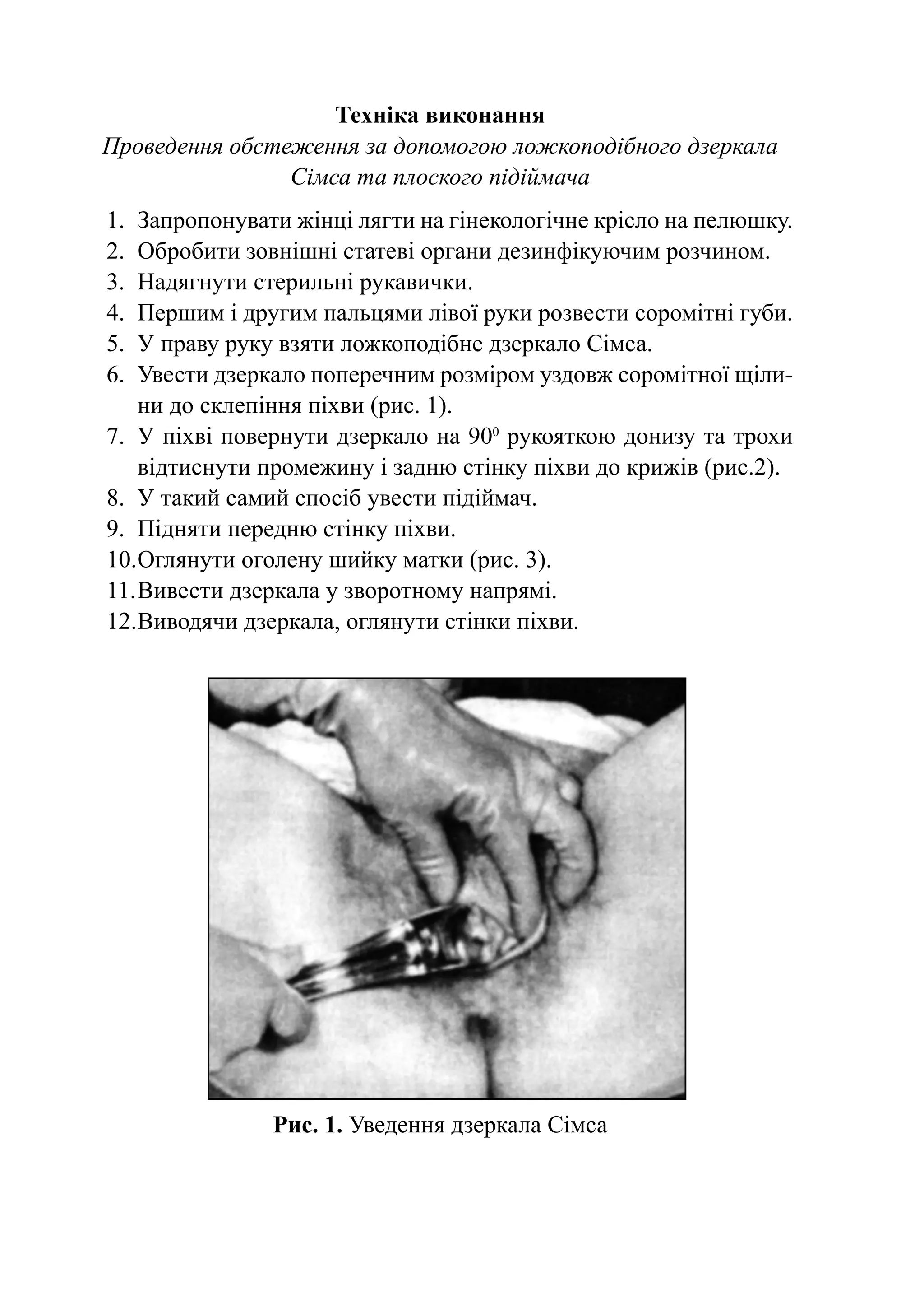 Техніка виконання
Проведення обстеження за допомогою ложкоподібного дзеркала
                Сімса та плоского підіймача
1.	 Запропонувати жінці лягти на гінекологічне крісло на пелюшку.
2.	 Обробити зовнішні статеві органи дезинфікуючим розчином.
3.	 Надягнути стерильні рукавички.
4.	 Першим і другим пальцями лівої руки розвести соромітні губи.
5.	 У праву руку взяти лож­ оподібне дзеркало Сімса.
                           к
6.	 Увести дзеркало попе­ еч­ им розміром уздовж со­ о­ ітної щіли-
                         р н                       р м
    ни до склепіння піхви (рис. 1).
7.	 У піхві повернути дзеркало на 900 рукояткою донизу та трохи
    відтиснути промежину і задню стінку піхви до крижів (рис.2).
8.	 У такий самий спосіб увести підіймач.
9.	 Підняти передню стінку піхви.
10.	 глянути оголену шийку матки (рис. 3).
    О
11.	Вивести дзеркала у зворотному напрямі.
12.	 иводячи дзеркала, оглянути стінки піхви.
    В




                Рис. 1. Уведення дзеркала Сімса
 