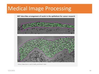 Medical Image Processing
7/22/2015 44
 