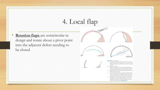 Algorithm to approach the lower extremity defect and to select ...