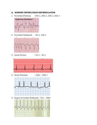 Algoritma acls | PDF