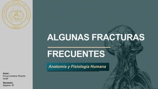 ALGUNAS FRACTURAS
FRECUENTES
Anatomía y Fisiología Humana
Autor:
Pucuji Centeno Ricardo
Israel
Semestre:
Séptimo “B”
 