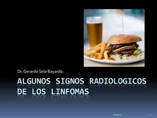 ALGUNOS SIGNOS RADIOLOGICOS
DE LOS LINFOMAS
Dr.Gerardo Sela Bayardo.
7/15/2013 1
 