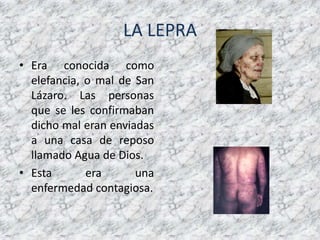 LA LEPRAEra conocida como elefancia, o mal de San Lázaro. Las personas que se les confirmaban dicho mal eran enviadas a una casa de reposo llamado Agua de Dios. Esta era una enfermedad contagiosa.