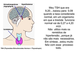 Meu TSH que era
9,20....baixou para 0,09
quando a taxa considerada
normal, em um organismo
em que a tireóide funciona
normal vai de 0,27 a 4,20
mUi.
Não utilizo mais os
remédios de
hipertensão...porque já
não são mais necessários.
Em síntese...estou muito
feliz com esse processo
todo.TSH (Thyreoidea-Stimulierendes Hormon = Thyreotropin)
 