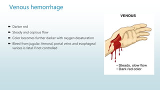 Venous hemorrhage
 Darker red
 Steady and copious flow
 Color becomes further darker with oxygen desaturation
 Bleed from jugular, femoral, portal veins and esophageal
varices is fatal if not controlled
 