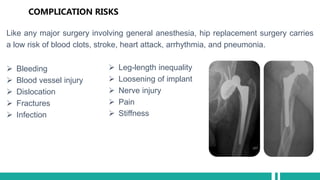 orthopedic-hip-bone-pptx