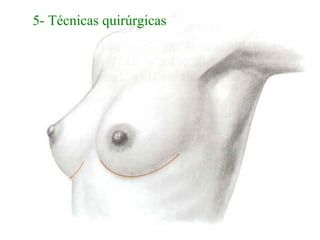 5- Técnicas quirúrgicas
 