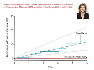 Hanne Meijers Heijboer: Breast Cancer after Prophylactic Bilateral Mastectomy
in Women with a BRCA1 or BRCA2 Mutation. N Engl J Med, 2001; 345(3)159-164
 