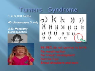 THE PUZZLE OF X CHROMOSOME 