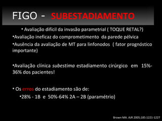 FIGO Estadiamento
- SUBESTADIAMENTO
• Avaliação difícil da invasão parametrial ( TOQUE RETAL?)
•Avaliação ineficaz do comprometimento da parede pélvica
•Ausência da avaliação de MT para linfonodos ( fator prognóstico
importante)

•Avaliação clínica subestima estadiamento cirúrgico em 15%36% dos pacientes!
• Os erros do estadiamento são de:
•28% - 1B e 50%-64% 2A – 2B (paramétrio)

Brown MA. AJR 2005;185:1221-1227

 