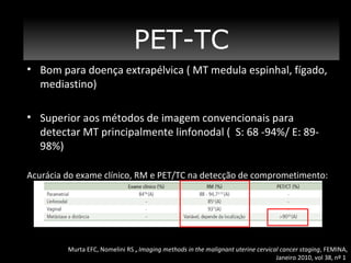 PET-TC
• Bom para doença extrapélvica ( MT medula espinhal, fígado,
mediastino)
• Superior aos métodos de imagem convencionais para
detectar MT principalmente linfonodal ( S: 68 -94%/ E: 8998%)
Acurácia do exame clínico, RM e PET/TC na detecção de comprometimento:

Murta EFC, Nomelini RS , Imaging methods in the malignant uterine cervical cancer staging, FEMINA,
Janeiro 2010, vol 38, nº 1

 
