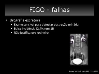 FIGO - falhas
• Urografia excretora
• Exame sensível para detectar obstrução urinária
• Baixa incidência (2,4%) em 1B
• Não justifica uso rotineiro

Brown MA. AJR 2005;185:1221-1227

 