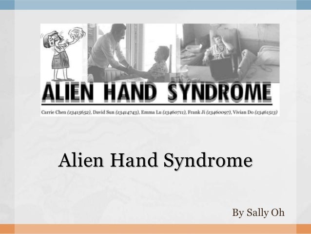 a study on the alien hand syndrome Alien hand syndrome, a rare neurological symptom, may be produced by a number of etiologies and more than one specific region of cerebral damage 1. a study on the alien hand syndrome Alien hand syndrome, a rare neurological symptom, may be produced by a number of etiologies and more than one specific region of cerebral damage 1.