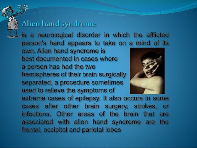a study on the alien hand syndrome Alien hand syndrome, a rare neurological symptom, may be produced by a number of etiologies and more than one specific region of cerebral damage 1. a study on the alien hand syndrome Alien hand syndrome, a rare neurological symptom, may be produced by a number of etiologies and more than one specific region of cerebral damage 1.