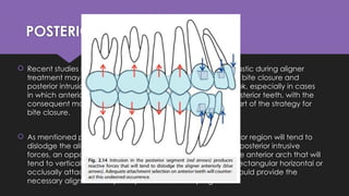 Aligner biomech-1.pptx biomechanics, orthodontics | PPTX