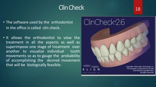 Clincheck Example Aligners | PPTX
