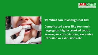 19. What can Invisalign not fix?
Complicated cases like too much
large gaps, highly crooked tooth,
severe jaw constrictions, excessive
intrusion or extrusions etc.
 