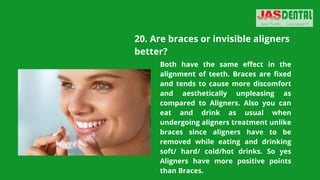 20. Are braces or invisible aligners
better?
Both have the same effect in the
alignment of teeth. Braces are fixed
and tends to cause more discomfort
and aesthetically unpleasing as
compared to Aligners. Also you can
eat and drink as usual when
undergoing aligners treatment unlike
braces since aligners have to be
removed while eating and drinking
soft/ hard/ cold/hot drinks. So yes
Aligners have more positive points
than Braces.
 