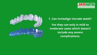 1. Can Invisalign intrude teeth?
Yes they can only in mild to
moderate cases which doesn’t
include any severe
complications.
 